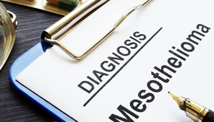 Diagnosing Mesothelioma